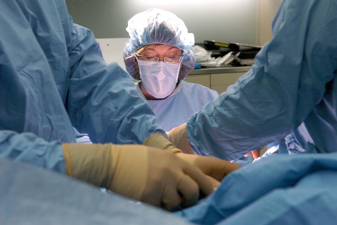 Chirurgie de marire a penisului